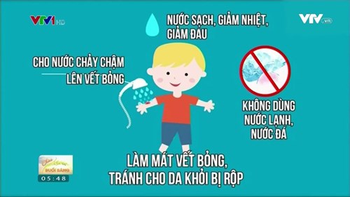 Hướng dẫn sơ cứu khi trẻ bị bỏng