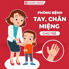 Bộ Y tế: Thực hiện ngay 3 sạch để phòng chống bệnh tay chân miệng